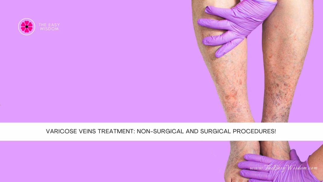 Varicose Veins Treatment Non-Surgical and Surgical Procedures- The Easy Wisdom- www.TheEasyWisdom.com